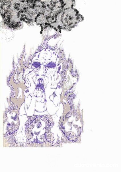 Хипотермия